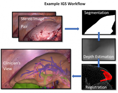 Example IGS workflow