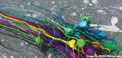 3D Reconstruction of Neurons